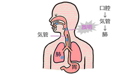 誤嚥とは